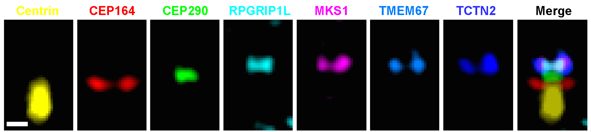 Superresolution Pattern Recognition Reveals the Architectural Map of the Ciliary Transition Zone