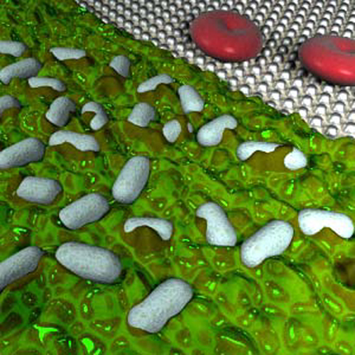 Functionalized arrays of Raman-enhancing nanoparticles for capture and culture-free analysis of bacteria in human blood